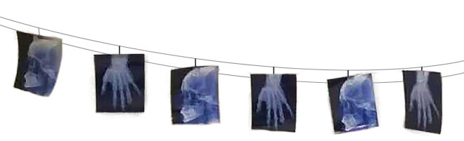 X-Ray skelet slinger