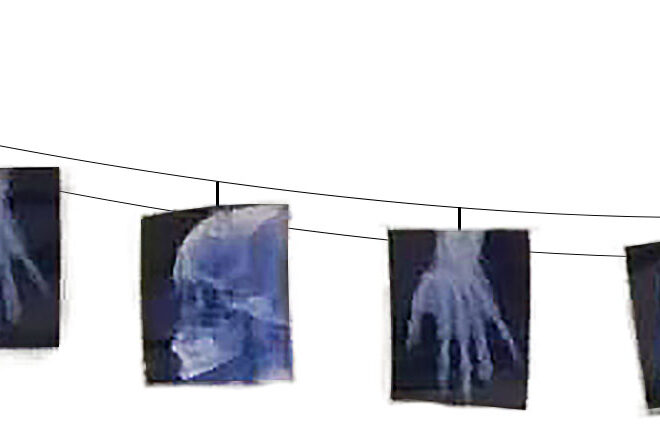 X-Ray skelet slinger